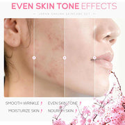 Before and after comparison of skin showing clear, smooth, and even tone after using Sakura Beauty Skin Care Set